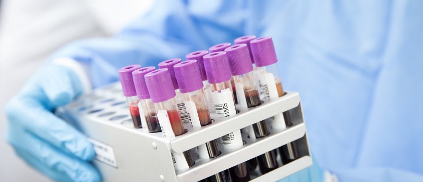 Rekord dzień po dniu. 903 nowe zakażenia w regionie. Zmarło 16 osób